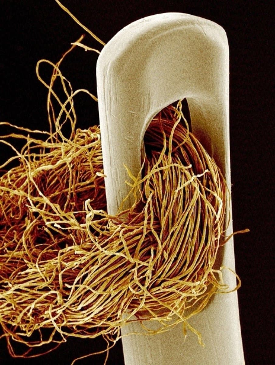 A close-up, false-color scanning electron micrograph showing a white sewing needle with a tangle of yellow and brown thread passing through its eye against a black background.