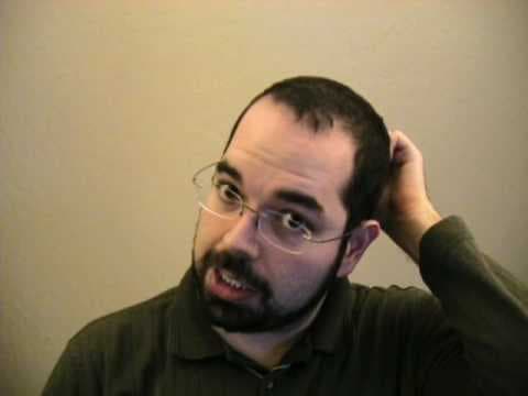 A close-up photograph of a man with short dark hair, a beard, and glasses, wearing a dark green shirt. He is looking to the side with a slightly confused or puzzled expression while scratching the back of his head with his left hand.