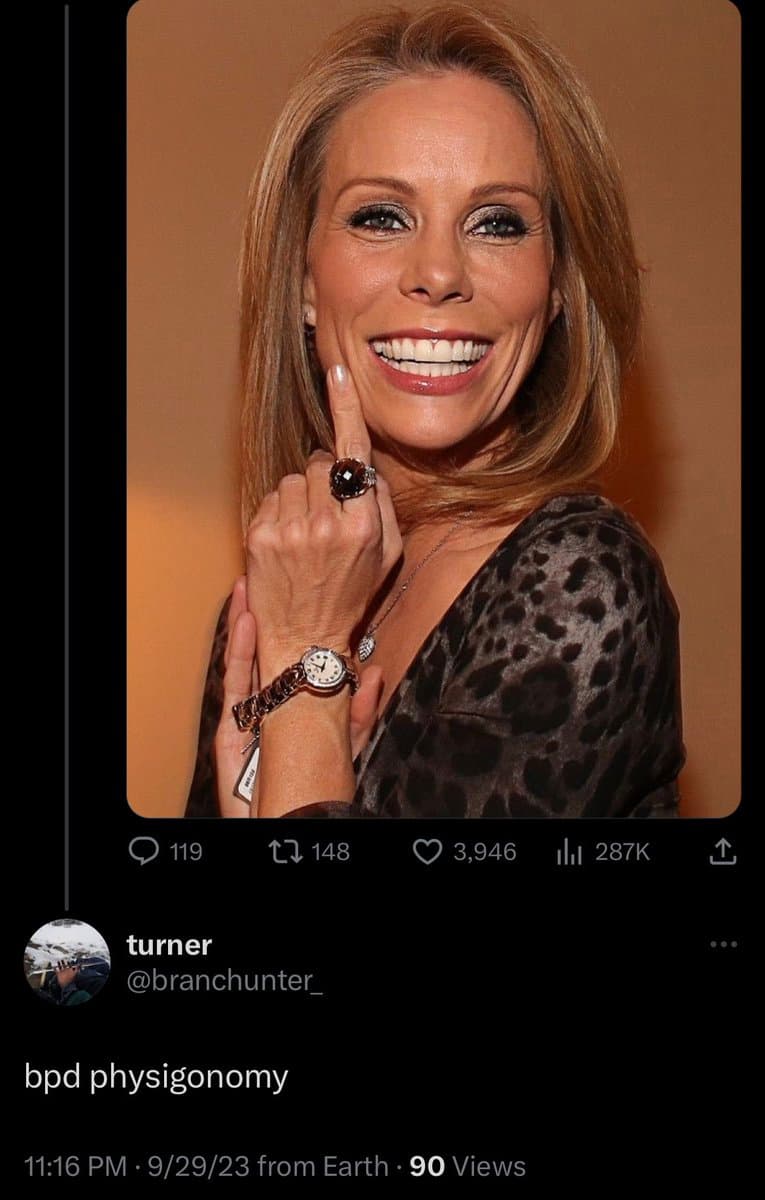 A screenshot of a social media post featuring a photo of a smiling woman with blonde hair, wearing a leopard-print top and a large ring, with her finger to her chin. The post includes the caption 'bpd physignomy' and is from a user named 'turner'.